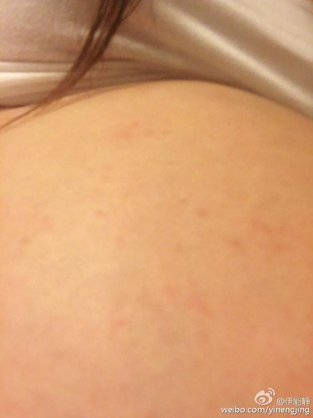 伊能靜臨產(chǎn)腳腫肚子過(guò)敏