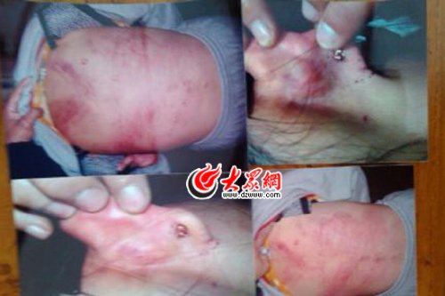 　山東藝術(shù)設(shè)計學(xué)院16歲女生宿舍內(nèi)被女同學(xué)暴打4小時。