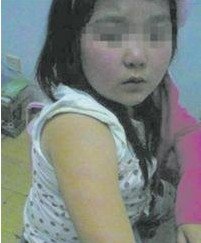 小學生沒考100分被老師打 兩個月不敢上學 小學生沒考100分被老師打 兩個月不敢上學