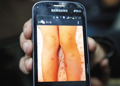 朝陽(yáng)一幼兒園 女老師長(zhǎng)期打多名兒童 朝陽(yáng)一幼兒園 女老師長(zhǎng)期打多名兒童