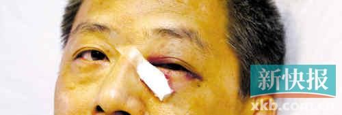 ■這起醫(yī)鬧事件，受傷的遠(yuǎn)遠(yuǎn)不只是熊旭明醫(yī)生的身體。