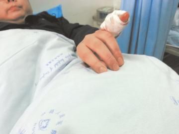 實(shí)習(xí)醫(yī)生陳洪左手的小拇指肌腱斷裂。