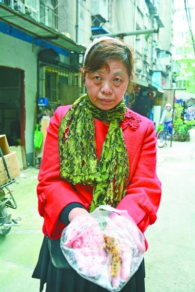 頭部受傷的黃女士展示兩根大魚刺。