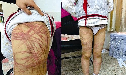 南京虐童案養(yǎng)母致歉：將用加倍關(guān)愛(ài)彌補(bǔ)過(guò)失