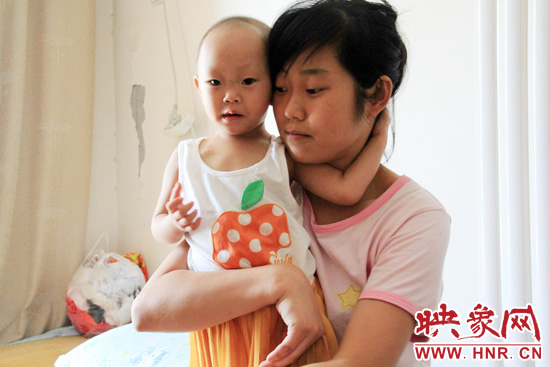 孩子和媽媽在一起，她的右眼已經(jīng)失明。