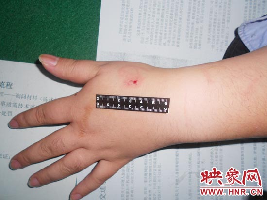 為幫助無(wú)證駕駛的朋友逃避處罰，新鄉(xiāng)的王某竟對(duì)執(zhí)勤民警大打出手，還將一名民警的手臂咬傷