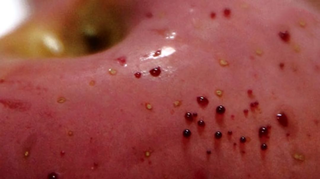 嚇懵！女子用熱水泡蘋(píng)果結(jié)果冒出血珠 咋回事？