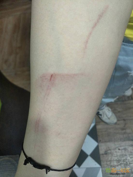 女網(wǎng)友舉報(bào)網(wǎng)帖中出示的被打后照片。