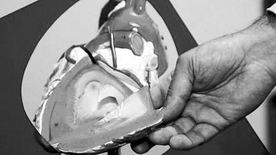 威廉斯領(lǐng)導(dǎo)的研究團(tuán)隊(duì)已經(jīng)利用人體脂肪干細(xì)胞，成功3D打印出心臟血管和心臟瓣膜，待一顆心臟的所有部件打