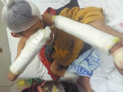 受傷的陳勝達(dá) 受傷的陳勝達(dá)