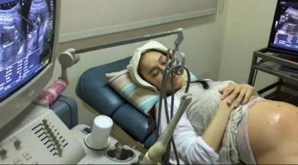 范瑋琪做B超 范瑋琪做B超