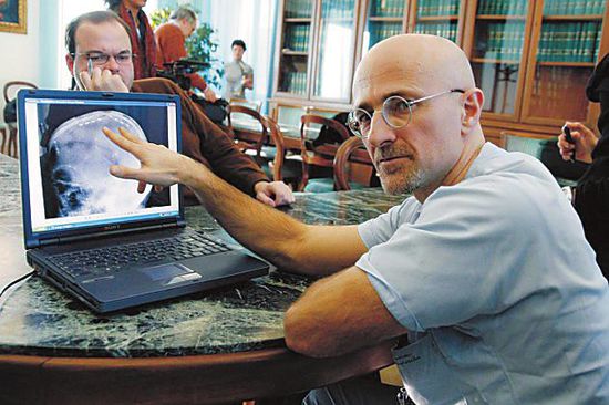 圖為卡納維洛醫(yī)生，不少人認(rèn)為他的想法非常瘋狂