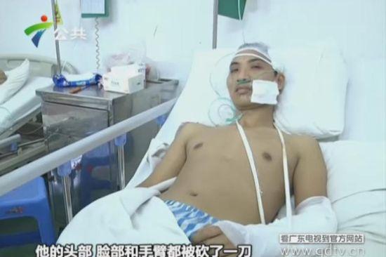 另一名傷者頭部、臉部和手臂都被砍了一刀。(視頻截圖)