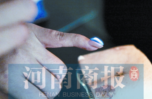 將指甲油涂在指甲上，靠近火焰時(shí)被引燃了