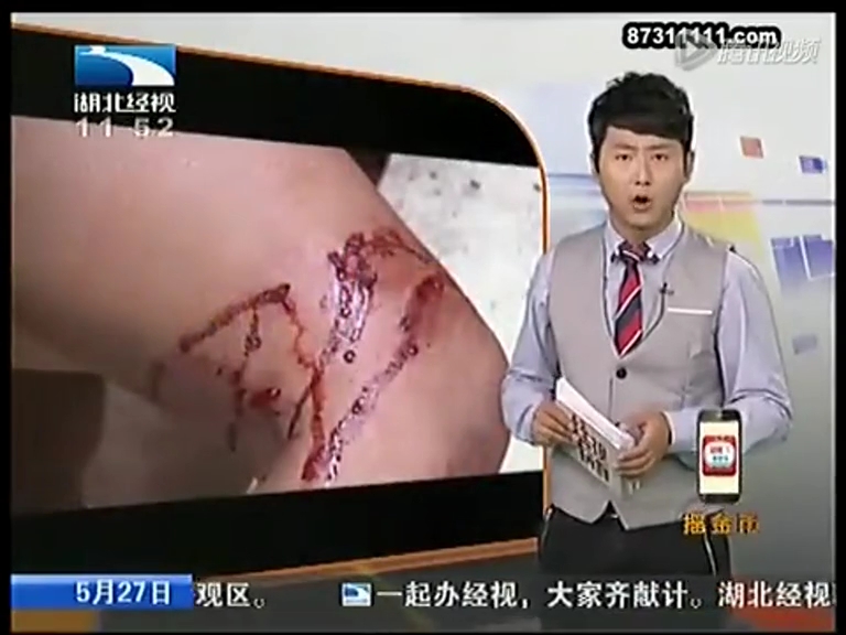 男子遭愛(ài)犬舔傷口 十天后因狂犬病喪命